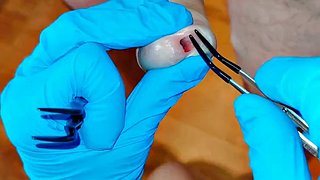 CFNM Nurse Part 3: Foreskin Stretching Treatment (Milking-time)